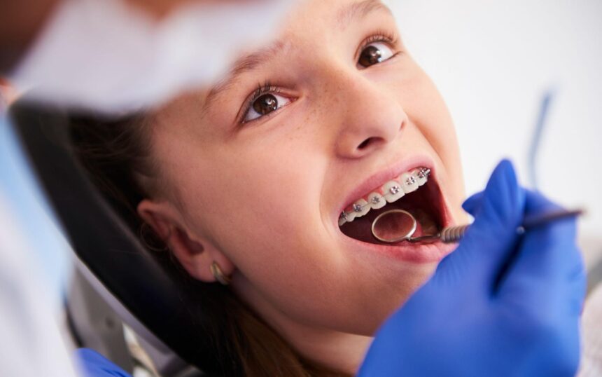 What Is The Best Dental Insurance For Braces