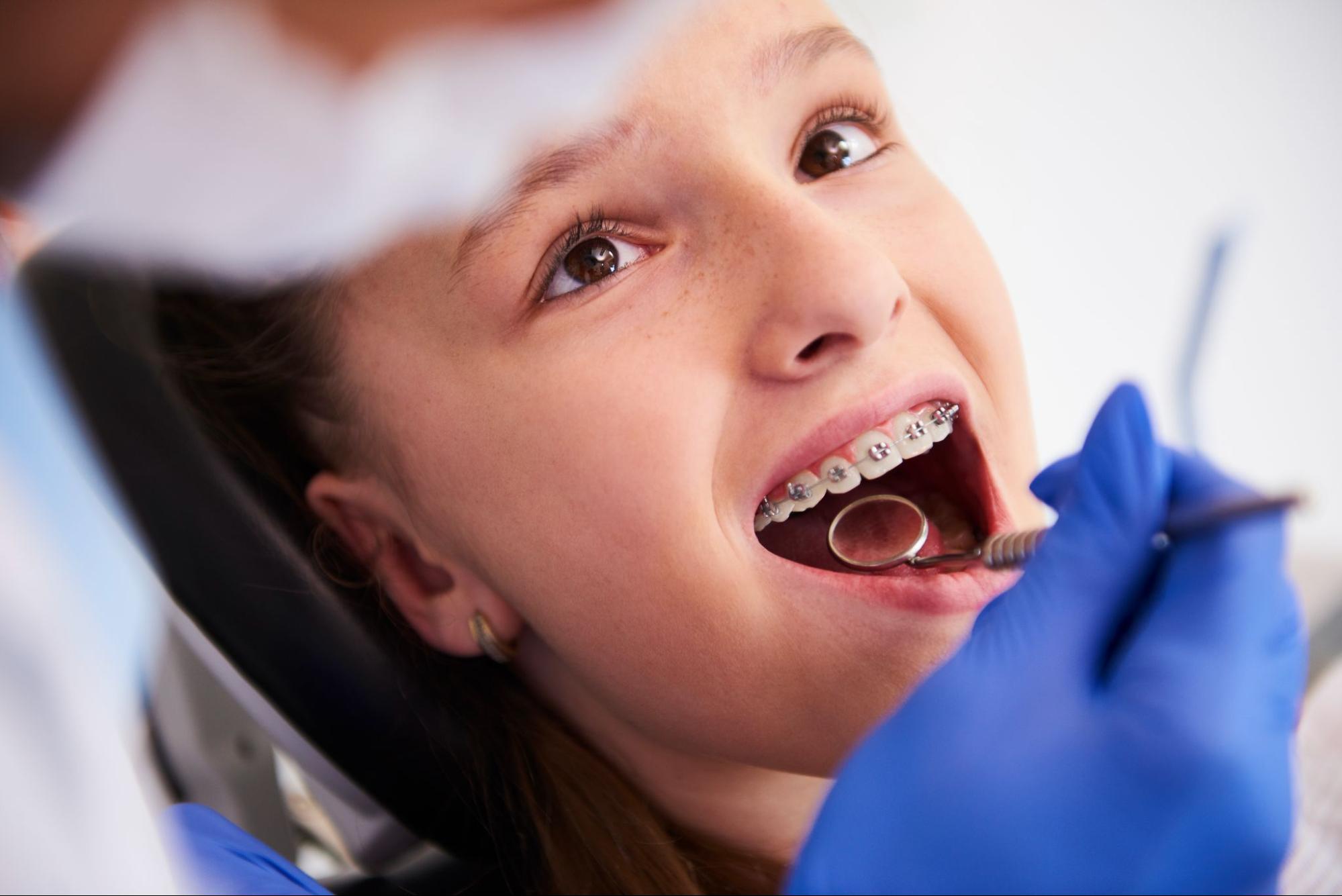 What Is The Best Dental Insurance For Braces